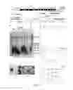 Fig. 34 - Human telomerase catalytic subunit