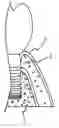 Fig. 01 - Implant surface treatment method having tissues integrated