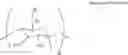 Fig. 02 - Stable Compositions Comprising Cationic Cellulose Polymers and Cellulase