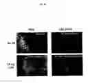 Fig. 87 - Flagellin related polypeptides and uses thereof