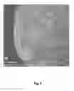 Fig. 04 - Catalyst support, process for its preparation and use
