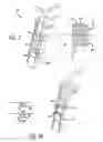 Fig. 03 - Blade insert illuminator