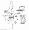 Fig. 01 - Sensing module for orthopedic load sensing insert device