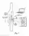Fig. 02 - Sensing module for orthopedic load sensing insert device