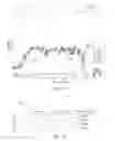 Fig. 11 - Implantable systems and methods for identifying a contra-ictal condition in a subject