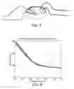 Fig. 06 - Apparatus and Method for Measuring Physiological Functions