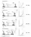 Fig. 12 - APPARATUS AND METHOD FOR MEASURING IN VIVO BIOMECHANICAL PROPERTIES OF SKIN