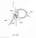 Fig. 06 - Convective Energy Transfer into the Eye
