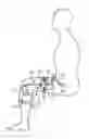 Fig. 01 - Patient-Wearable System, Twist Isolating Device, And Method