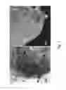 Fig. 02 - Apparatus and methods for percutaneous cochlear implantation