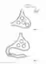 Fig. 02 - Gastric space occupier systems and methods of use