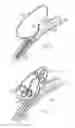 Fig. 04 - Sacrificial anode stent system