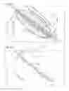 Fig. 06 - Bidirectional self-retaining sutures with laser-marked and/or non-laser marked indicia and methods