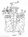 Fig. 02 - SUTURE BONE ANCHOR