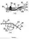 Fig. 07 - SUTURE BONE ANCHOR