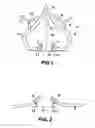 Fig. 02 - Simple portable lumbar spine distraction device and method