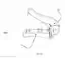 Fig. 04 - Interarticulating spinous and transverse process staples for spinal fusion
