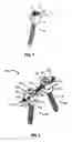 Fig. 02 - Compression-distraction spinal fixation system and kit