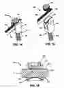 Fig. 07 - Compression-distraction spinal fixation system and kit