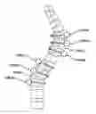 Fig. 01 - Non-fusion spinal correction systems and methods