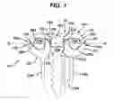 Fig. 02 - Non-fusion spinal correction systems and methods
