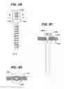 Fig. 07 - Non-fusion spinal correction systems and methods