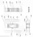 Fig. 02 - Flexible plate fixation of bone fractures
