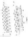 Fig. 09 - Flexible plate fixation of bone fractures