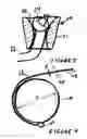 Fig. 03 - LATERAL SUTURE SCREW