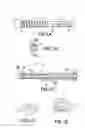 Fig. 02 - Bone implantation and stabilization assembly including deployment device