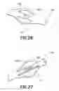 Fig. 28 - Bone implantation and stabilization assembly including deployment device