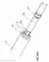 Fig. 45 - Bone implantation and stabilization assembly including deployment device