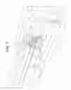 Fig. 08 - Intracardiac defibrillation catheter system