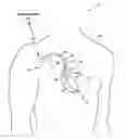 Fig. 01 - Terminating tachyarrhythmias
