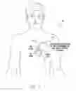 Fig. 02 - Systems and methods for use by an implantable medical device for controlling multi-site CRT pacing in the presence of atrial tachycardia