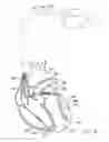 Fig. 09 - Systems and methods for use by an implantable medical device for controlling multi-site CRT pacing in the presence of atrial tachycardia