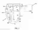 Fig. 02 - Systems, devices and methods relating to endocardial pacing for resynchronization
