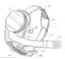 Fig. 01 - Retinal prosthesis with side mounted inductive coil