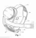 Fig. 02 - Retinal prosthesis with side mounted inductive coil
