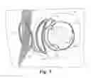 Fig. 06 - Retinal prosthesis with side mounted inductive coil