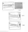 Fig. 05 - METHOD AND CONTROL SYSTEM FOR A TREATMENT BY SUBCUTANEOUS OR INTRACUTANEOUS IRRADIATION BY MEANS OF ELECTROMAGNETIC RADIATION