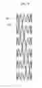 Fig. 06 - STENT AND METHOD OF MOUNTING THE SAME
