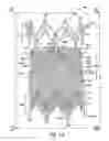 Fig. 02 - Venous valve, system, and method