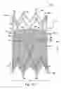 Fig. 06 - Venous valve, system, and method