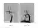 Fig. 05 - Branched stent graft
