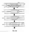 Fig. 06 - METHODS AND APPARATUS FOR LOCALIZED ADMINISTRATION OF INHIBITORY MOIETIES TO A PATIENT