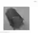 Fig. 05 - MEDICAL IMPLANT