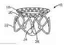 Fig. 01 - Transcatheter mitral valve prosthesis