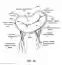 Fig. 07 - Transcatheter mitral valve prosthesis