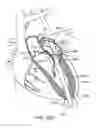 Fig. 32 - Transcatheter mitral valve prosthesis